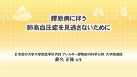 [肺高血圧症]膠原病に伴う肺高血圧症を見逃さないために