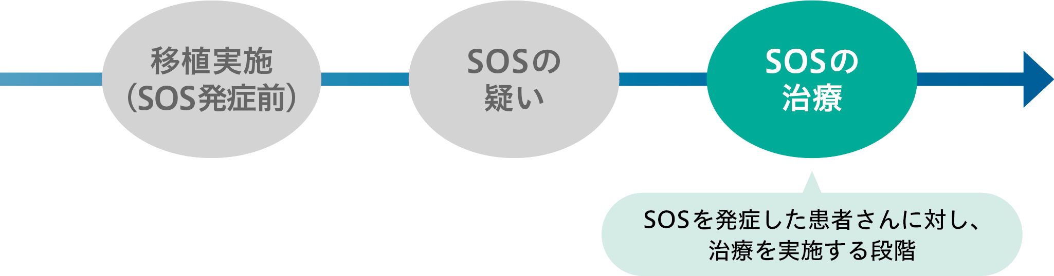 SOSの発症