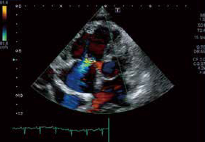 心エコー図検査を実施もしくはオーダーする医師・臨床検査技師の先生方