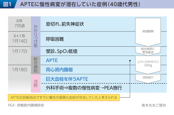 図1 APTEに慢性病変が潜在していた症例（40歳代男性）